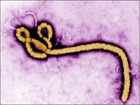 afrique-de-l-ouest-omnisports-3e-jeux-de-la-cedeao---la-fievre-ebola-fait-reporter-la-competition